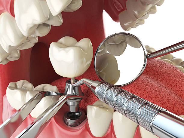 Best Emergency Denture Repair in Louisville, TN